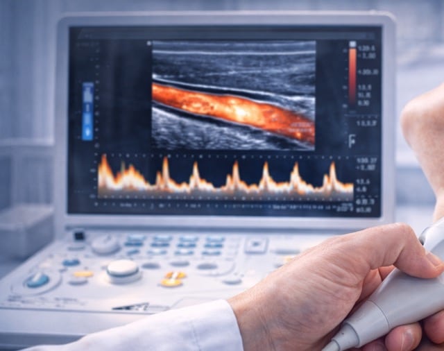 Ultraschall der Halsschlagader